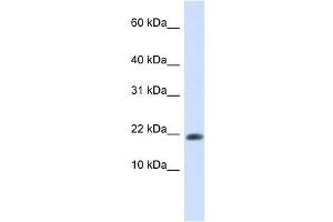 GABARAPL2 antibody used at 1 ug/ml to detect target protein. (GABARAPL2 抗体)