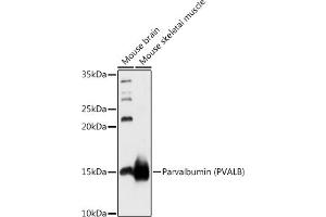 Western blot analysis of extracts of various cell lines, using Parvalbumin (PVALB) antibody (ABIN6128526, ABIN6146506, ABIN6146507 and ABIN6217573) at 1:1000 dilution. (PVALB 抗体  (AA 1-110))