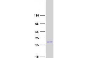 ZSCAN2 Protein (Transcript Variant 3) (Myc-DYKDDDDK Tag)