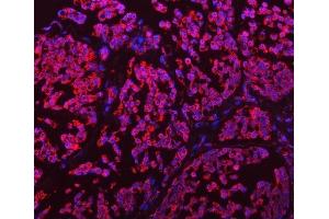 anti-GLUD1 / GLUD2 (AA 54-553) antibody