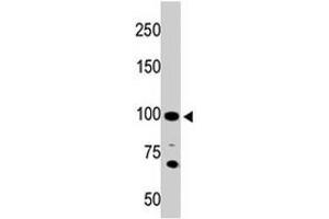 The ACE2 polyclonal antibody  is used in Western blot to detect ACE2 in 293 cell lysate. (ACE2 抗体  (AA 773-805))
