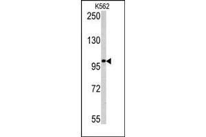 Image no. 1 for anti-Melanoma Antigen Family C, 1 (MAGEC1) (C-Term) antibody (ABIN358656) (MAGEC1 抗体  (C-Term))