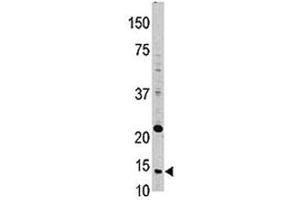 Western blot analysis of Thioredoxin in HL-60 lysate (TXN 抗体  (AA 1-30))