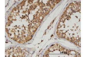 Image no. 1 for anti-Angiopoietin-Like 3 (ANGPTL3) (AA 17-461) antibody (ABIN599551) (ANGPTL3 抗体  (AA 17-461))