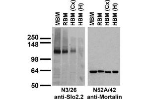 Immunoblot against brain membranes from adult rat (RBM), mouse (MBM) or human cerebral cortex [HBM(Cx)] or hippocampus [HBM(H)] probed with N3/26 (left) or N52A/42 (right) TC supe.