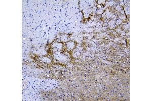 Immunohistochemistry (IHC) image for anti-Synaptotagmin I (SYT1) antibody (ABIN5692948)
