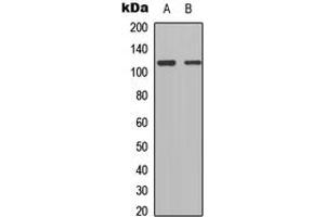 Western blot analysis of TSHZ1 expression in HEK293T (A), Raw264. (TSHZ1 抗体  (C-Term))