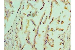 Immunohistochemistry of paraffin-embedded human prostate tissue using ABIN7151949 at dilution of 1:100 (EPHX1 抗体  (AA 1-455))