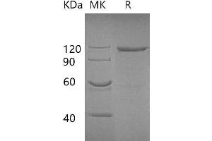 Western Blotting (WB) image for Galactosidase, beta 1 (GLB1) protein (Fc Tag) (ABIN7320988) (GLB1 Protein (Fc Tag))