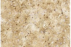 Immunohistochemical analysis of paraffin-embedded Human brain section using Pink1 B. (GFAP 抗体)