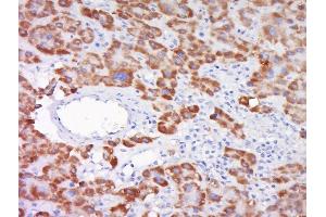 Immunohistochemistry (Paraffin-embedded Sections) (IHC (p)) image for anti-Superoxide Dismutase 1, Soluble (SOD1) (AA 6-100) antibody (ABIN2179338)
