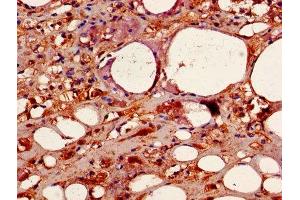 Immunohistochemistry of paraffin-embedded human adrenal gland tissue using ABIN7146893 at dilution of 1:100 (CSNK2B 抗体  (AA 1-215))