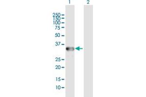 Western Blot analysis of ANXA3 expression in transfected 293T cell line by ANXA3 MaxPab polyclonal antibody. (Annexin A3 抗体  (AA 1-323))