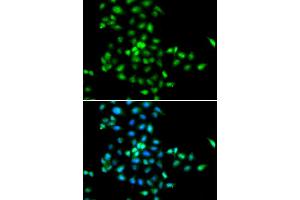 Immunofluorescence (IF) image for anti-Shwachman-Bodian-Diamond Syndrome (SBDS) antibody (ABIN1980243) (SBDS 抗体)