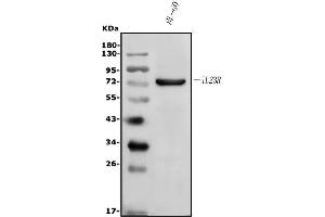 Western blot analysis of IL23 Receptor/IL23R using anti-IL23 Receptor/IL23R antibody (ABIN7603758).