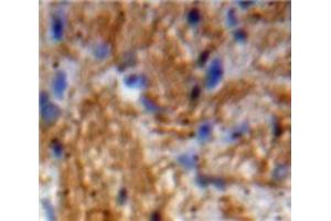 Used in DAB staining on fromalin fixed paraffin-embedded Brain tissue (Neurotrophin 3 抗体  (AA 21-138))