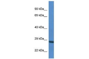WB Suggested Anti-RAB6C AntibodyTitration: 1. (WTH3DI 抗体  (Middle Region))
