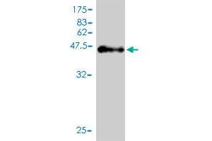 Western Blot detection against Immunogen (46. (DNAH14 抗体  (AA 1-189))