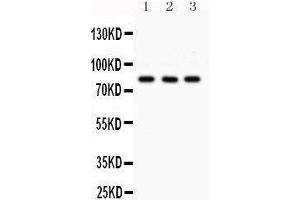 Western Blotting (WB) image for anti-Sp3 Transcription Factor (Sp3) (AA 569-599), (C-Term) antibody (ABIN3043350) (Sp3 抗体  (C-Term))