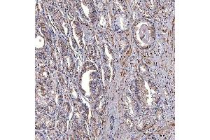 IHC analysis of TRMT2B using anti-TRMT2B antibody (ABIN7599456).