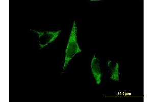 Immunofluorescence of purified MaxPab antibody to MGC48915 on HeLa cell.
