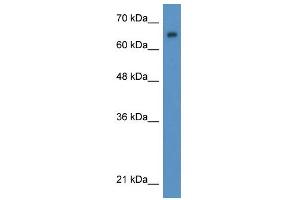 WB Suggested Anti-WT1 Antibody Titration:  0. (WT1 抗体  (N-Term))