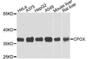 Western blot analysis of extracts of various cells, using CPOX antibody. (CPOX 抗体)