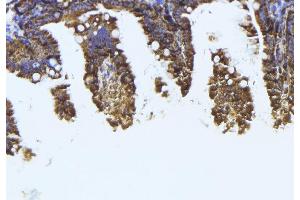 ABIN6273994 at 1/100 staining Mouse colon tissue by IHC-P. (TUBB1 抗体)