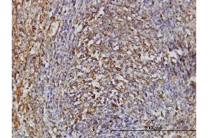 Immunoperoxidase of monoclonal antibody to TPMT on formalin-fixed paraffin-embedded human spleen. (TPMT 抗体  (AA 1-245))