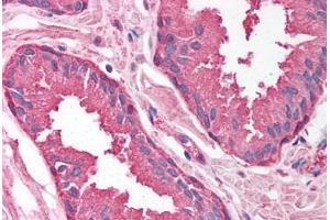 Immunohistochemistry (Paraffin-embedded Sections) (IHC (p)) image for anti-Proteasome Subunit alpha Type 1 (PSMA1) (AA 170-219) antibody (ABIN6736748)