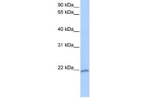 Western Blot showing C8orf77 antibody used at a concentration of 1-2 ug/ml to detect its target protein. (C8orf77 抗体  (C-Term))