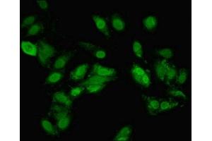 Immunofluorescence (IF) image for anti-Tankyrase, TRF1-Interacting Ankyrin-Related ADP-Ribose Polymerase 2 (TNKS2) (AA 1-246) antibody (ABIN7171500)
