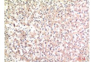 Immunohistochemistry (IHC) analysis of paraffin-embedded Human Liver, antibody was diluted at 1:100. (Complement C4A/C4B (Internal Region) 抗体)