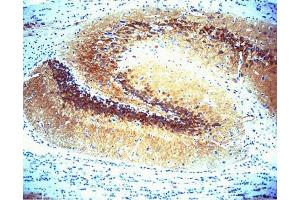 Immunohistochemical staining of CaM Kinase II on rat brain (center panel). (CAMK2A 抗体  (AA 448-460))