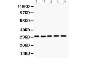 Anti- CD82 Picoband antibody, Western blottingAll lanes: Anti CD82  at 0. (CD82 抗体  (AA 98-267))