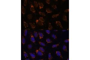 Immunofluorescence analysis of U-2 OS cells using TSFM Polyclonal Antibody (ABIN7271022) at dilution of 1:100 (40x lens). (TSFM 抗体  (AA 245-346))