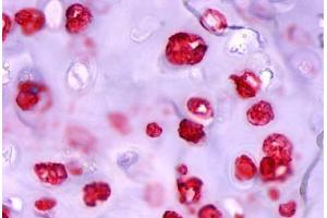 Anti-ADAMTS4 antibody  ABIN1048291 IHC staining of human cartilage.