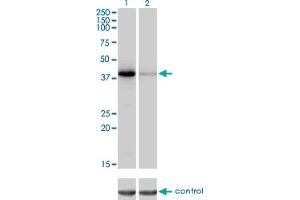 Western blot analysis of NEIL2 over-expressed 293 cell line, cotransfected with NEIL2 Validated Chimera RNAi (Lane 2) or non-transfected control (Lane 1). (NEIL2 抗体  (AA 1-332))
