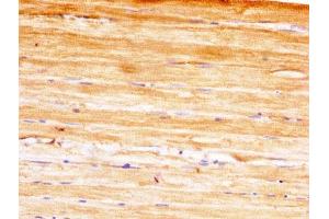 Immunohistochemistry (IHC) image for anti-14-3-3 eta (YWHAH) (AA 4-246) antibody (ABIN7142091)