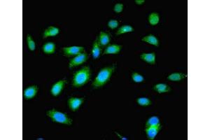 Immunofluorescent analysis of Hela cells using ABIN7174654 at dilution of 1:100 and Alexa Fluor 488-congugated AffiniPure Goat Anti-Rabbit IgG(H+L) (OGT 抗体  (AA 606-1022))