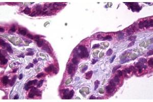 Anti-SKI antibody IHC staining of human placenta. (SKI 抗体)