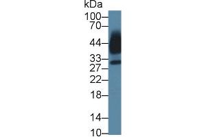 Detection of KLK13 in Human Saliva using Polyclonal Antibody to Kallikrein 13 (KLK13) (Kallikrein 13 抗体  (AA 25-261))