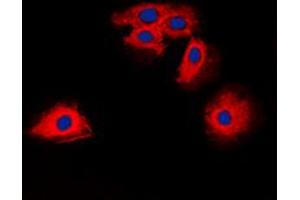 Immunofluorescent analysis of Claudin 6 staining in HuvEc cells. (Claudin 6 抗体  (Center))