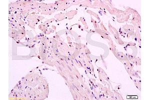 Formalin-fixed and paraffin embedded rat myocardium tissue labeled with Anti-SMURF2 Polyclonal Antibody, Unconjugated (ABIN753178) at 1:200 followed by conjugation to the secondary antibody and DAB staining (SMURF2 抗体  (AA 601-700))