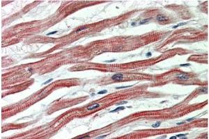 Staining of paraffin embedded Human Heart using EPM2AIP1 antibody at 5 µg/ml. (EPM2AIP1 抗体  (Internal Region))