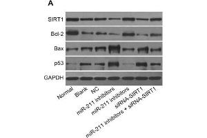 Western Blotting (WB) image for anti-B-Cell CLL/lymphoma 2 (BCL2) (AA 151-239) antibody (ABIN5675264)