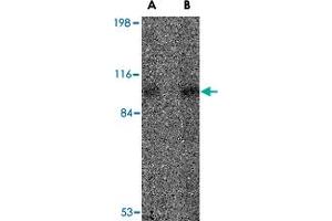 Western blot analysis of VPS53 in 293 cell lysate with VPS53 polyclonal antibody  at (A) 0. (VPS53 抗体  (Internal Region))