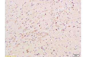 Formalin-fixed and paraffin embedded mouse brain tissue labeled with Anti-CHRNA7 Polyclonal Antibody, Unconjugated  at 1:200, followed by conjugation to the secondary antibody and DAB staining (CHRNA7 抗体  (AA 441-502))
