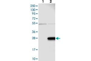 Western blot analysis of Lane 1: Negative control (vector only transfected HEK293T lysate), Lane 2: Over-expression Lysate (Co-expressed with a C-terminal myc-DDK tag (~3. (ZMAT5 抗体)