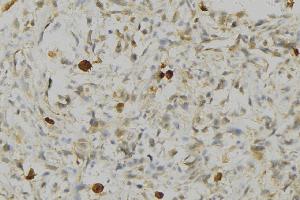 ABIN6276738 at 1/100 staining Human gastric tissue by IHC-P. (HLA-DRA 抗体)